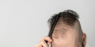 Topical Finasteride – Minoxidil Spray Explained