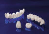 From Start to Smile ─ Unveiling the Zirconia Crown Creation Journey