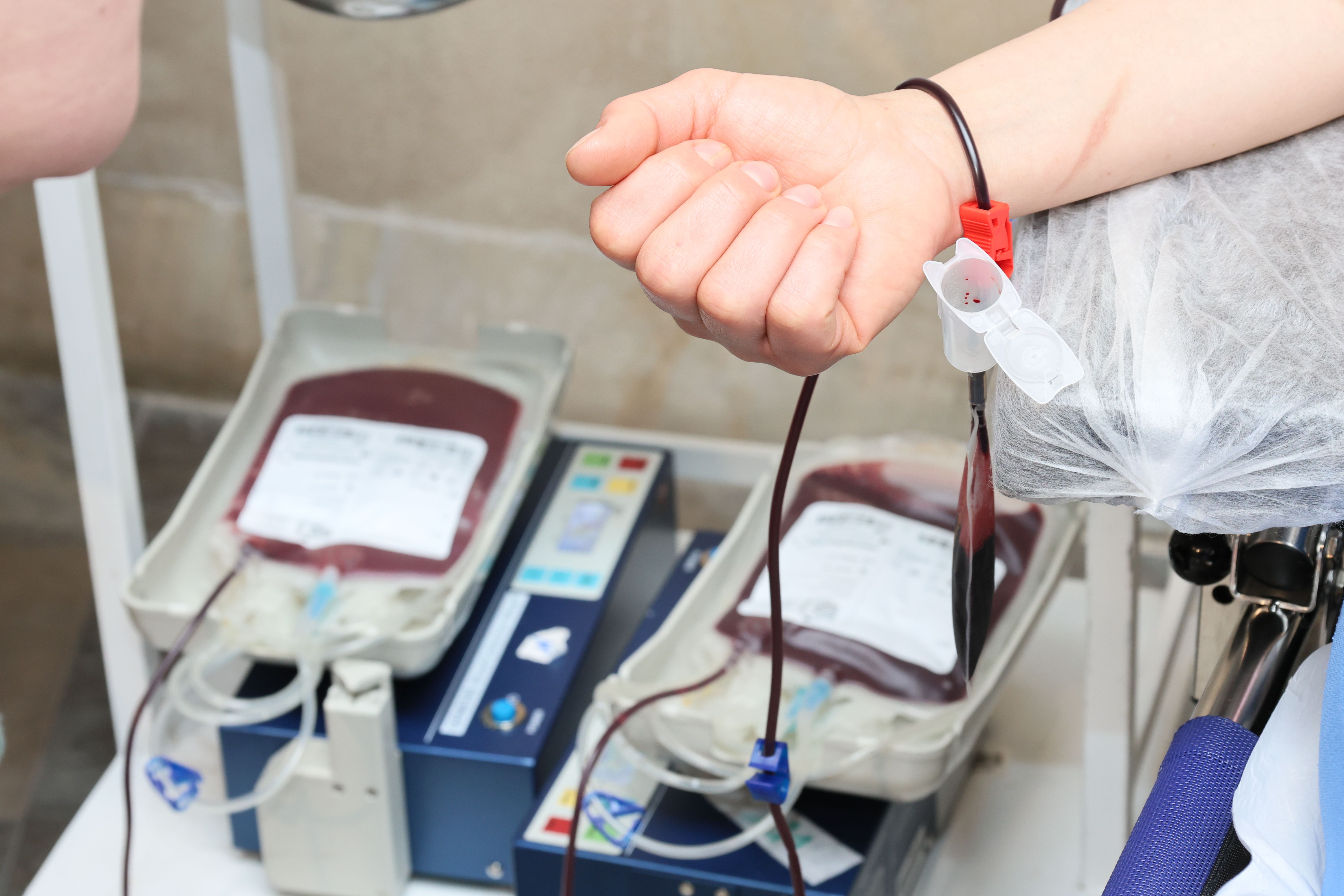 Close-up of a donor’s arm and collection bags during a clinic donation procedure.